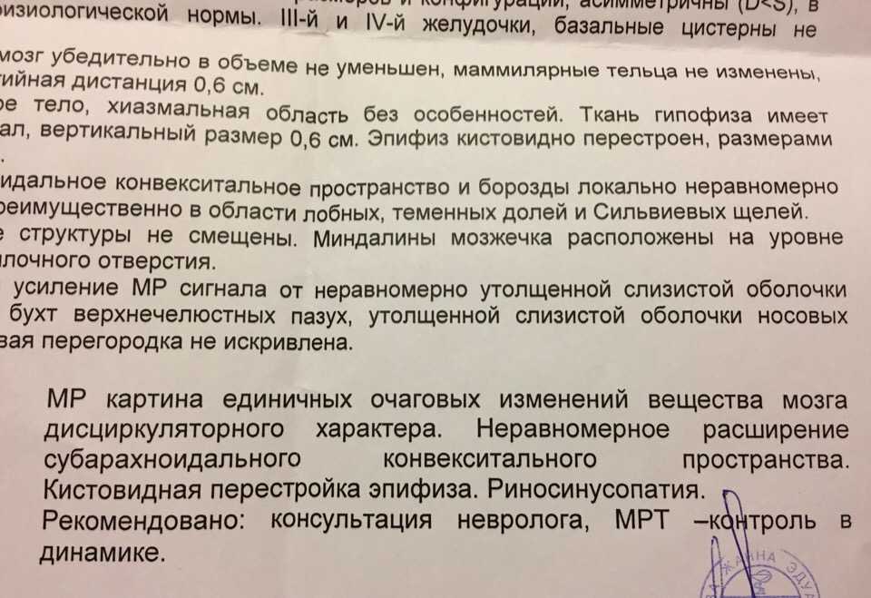Очаговые изменения мозга: развитие, виды, симптомы, опасны или нет, как лечить