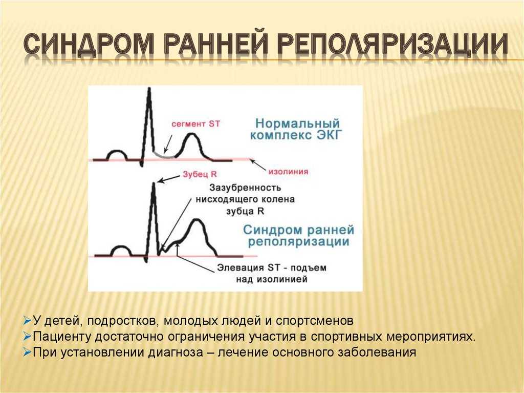 Синдром clc