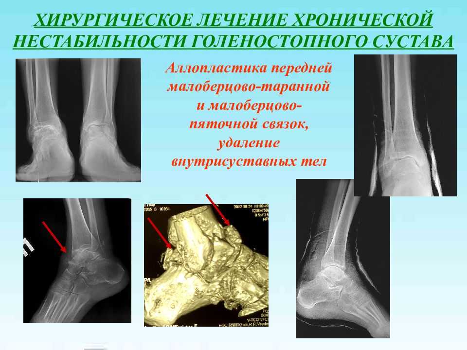 Влияние физических нагрузок на опорно-двигательный аппарат и функциональное состояние спортсменов | статья в журнале «молодой ученый»