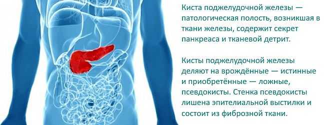 Кт поджелудочной железы