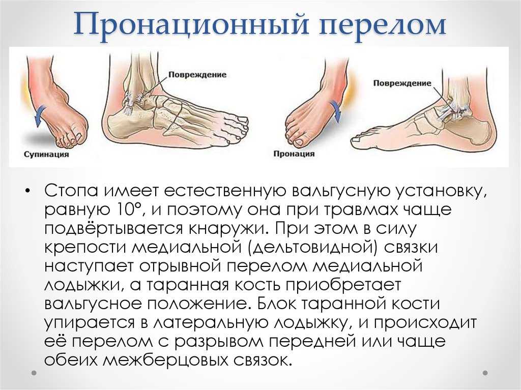 Первая помощь при переломе