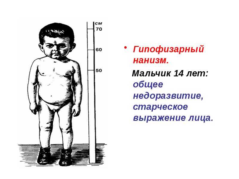 Причины и симптомы задержки физического развития у детей | дефектология проф