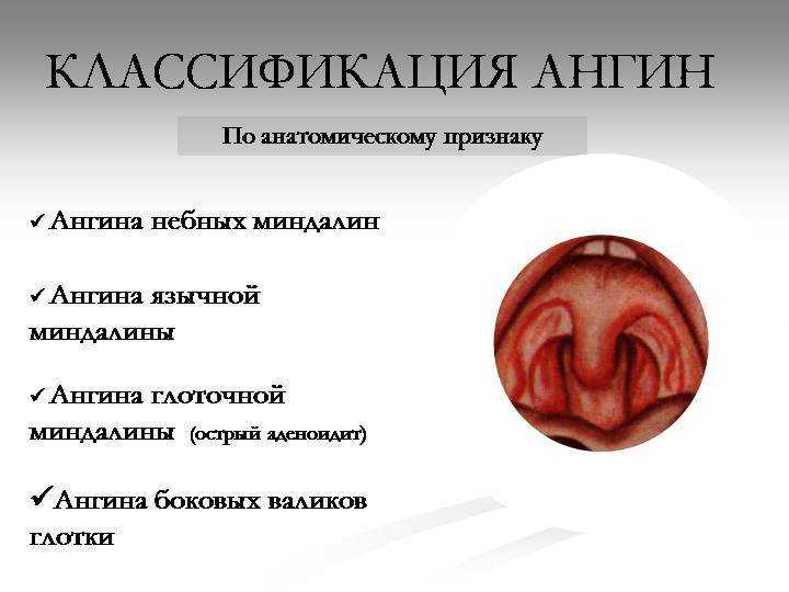 Виды ангины - му "поликлиника фнпр"