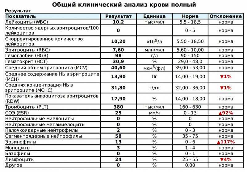 Оса насекомое. описание, особенности, образ жизни и среда обитания осы