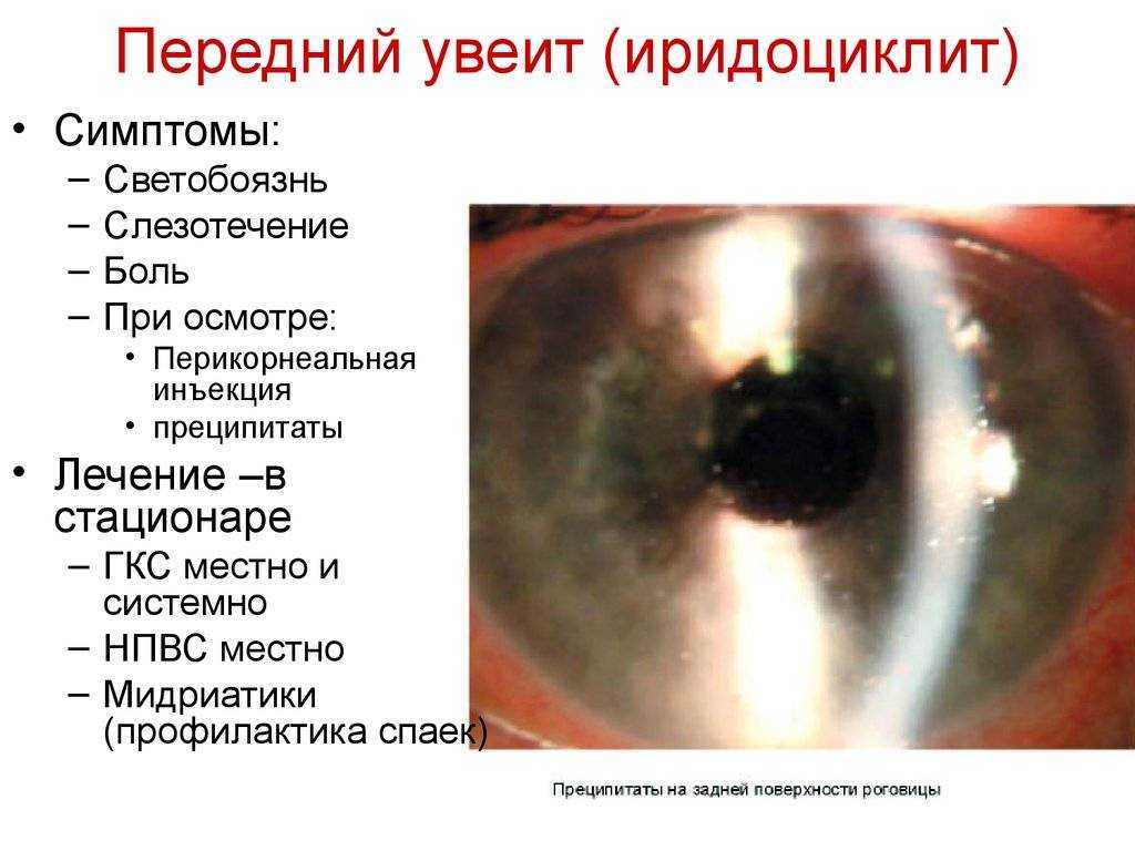 Периферические дистрофии сетчатки глаза (пхрд, пвхрд) - что это такое и как лечить