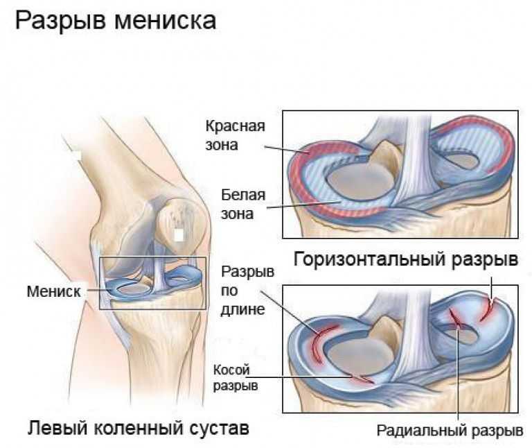 Теории старения