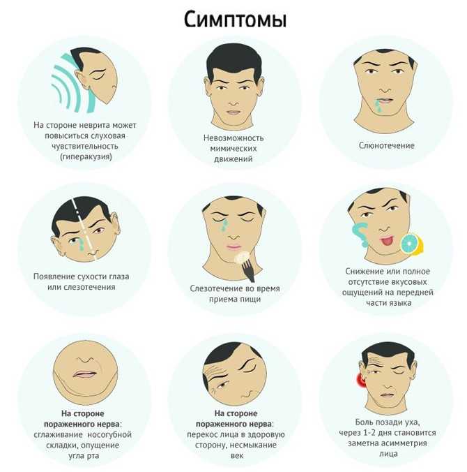 Онемение конечностей и языка при всд | элтацин®
