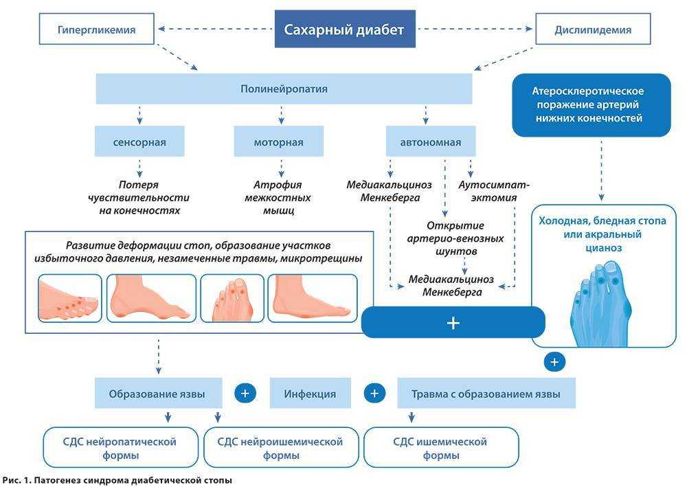 Лечебная диета (стол) №9 по певзнеру таблица продуктов, г. барнаул, алтайский край, медицинский центр валеомед