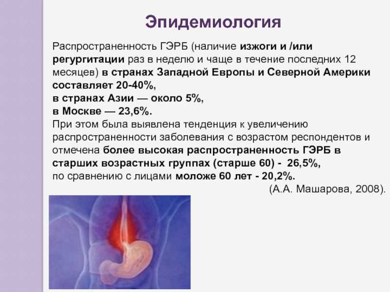 Эзофагит: что это и на сколько страшно? - клиника в уручье