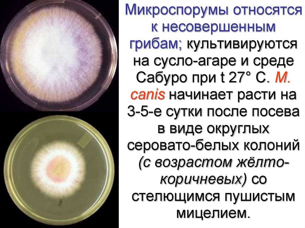 Микроспория