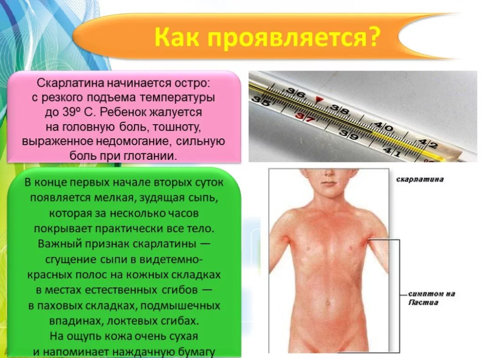 Скарлатина относится к инфекционным заболеваниям преимущественно детей, вызываемой стрептококком группы А Клиническая картина обусловлена попаданием в кровь эритротоксина, продуцируемого возбудителем заболевания