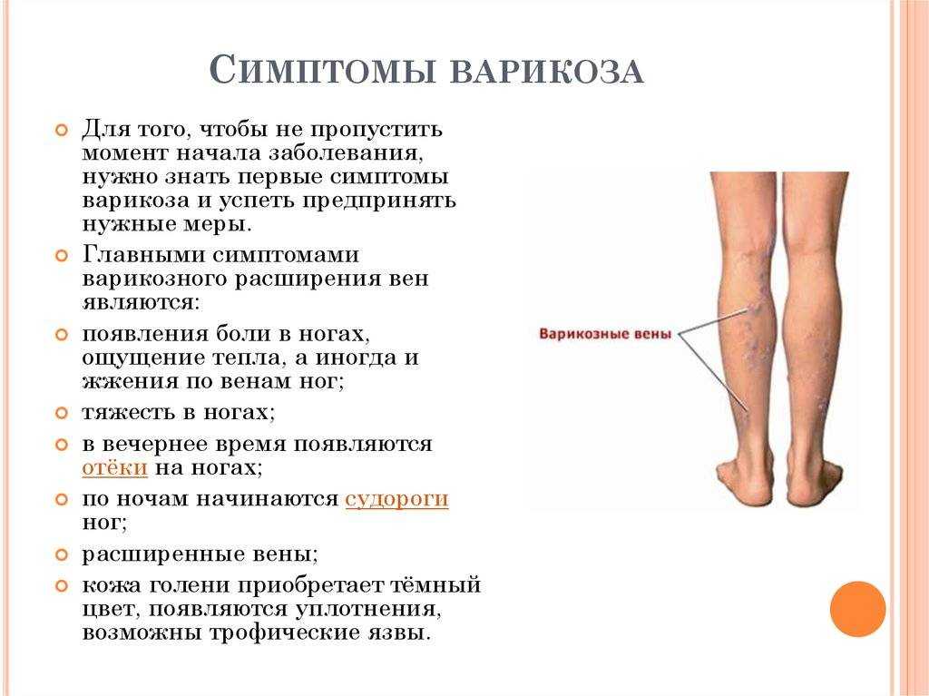 Флебит нижних конечностей - симптомы и лечение. воспаление вен на руках и ногах - medside.ru
