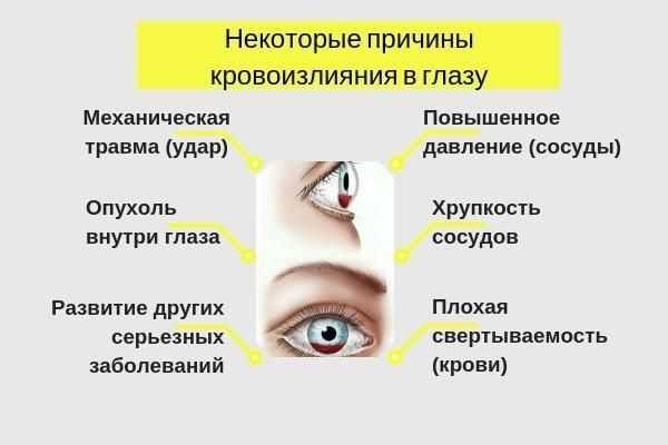 Тромбоз сосудов глаза: симптоматика и лечение патологии