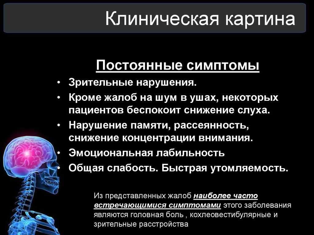 Вертебро-базилярная недостаточность: симптомы и лечение