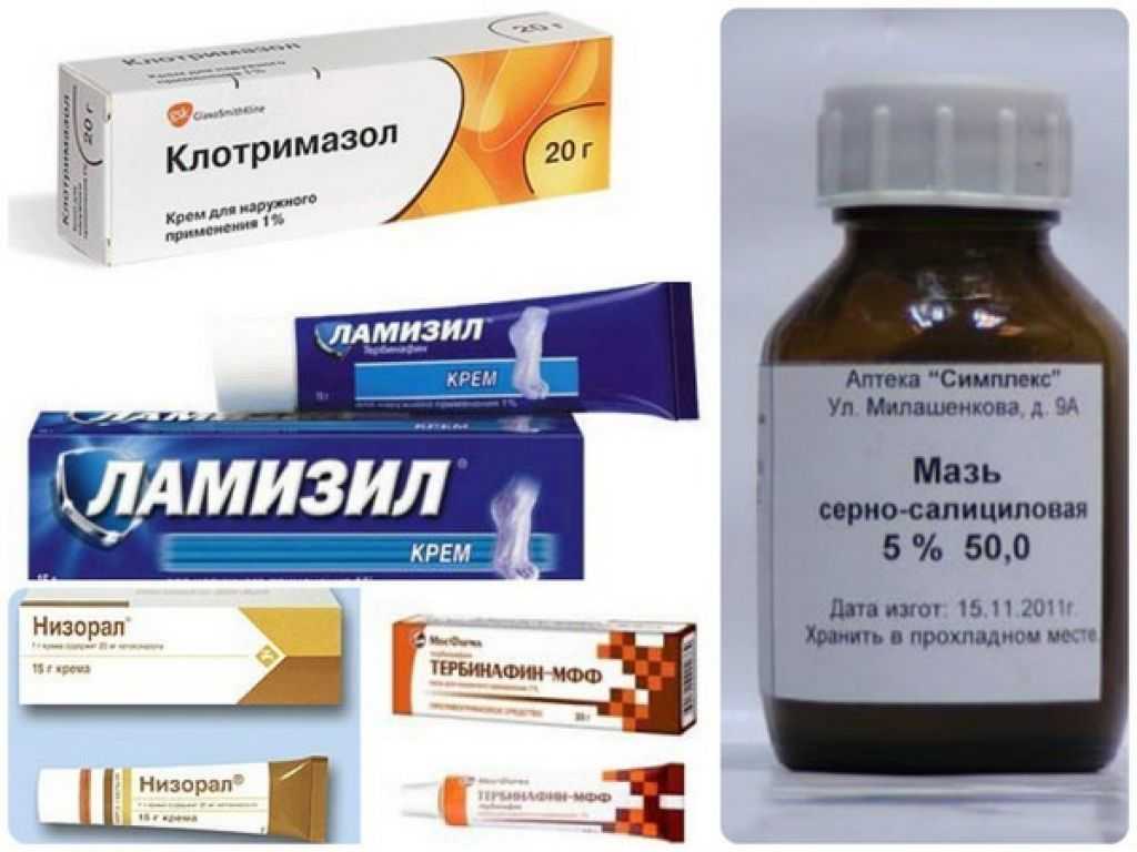 Красный плоский лишай