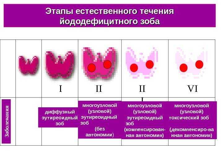 Узи щитовидной железы - патология (лекция на диагностере) - диагностер