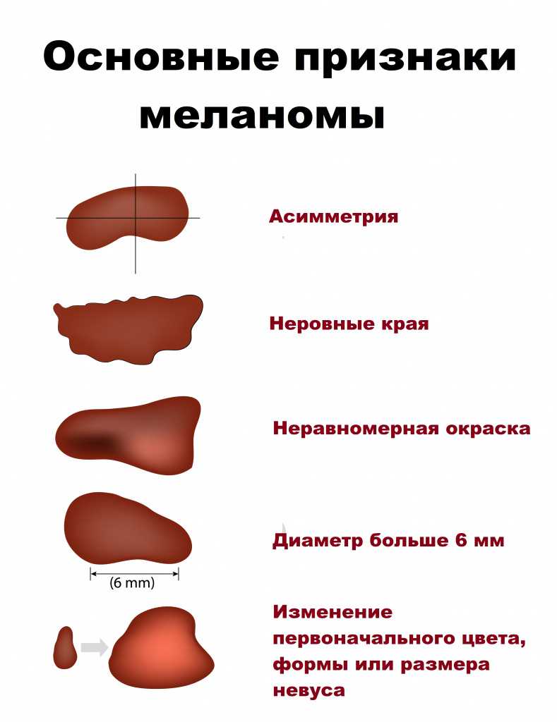 12 проблем с ногтями, которые служат симптомами заболеваний – не пропустите их | evolutis clinic | дзен