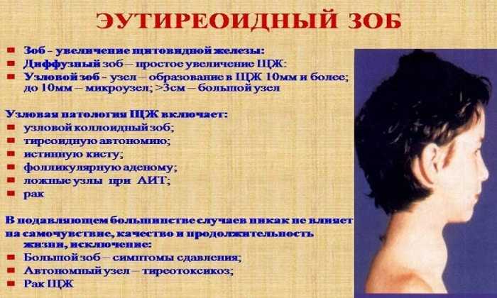 Базедова болезнь (диффузный токсический зоб) - причины, симптомы, признаки. диагностика и лечение патологии. осложнения и последствия. профилактика и прогноз