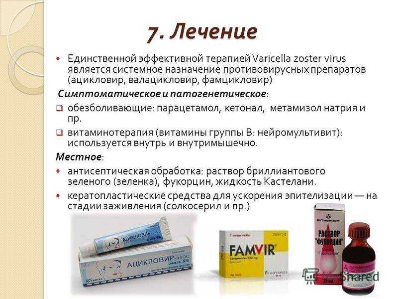 Лишай у ребенка