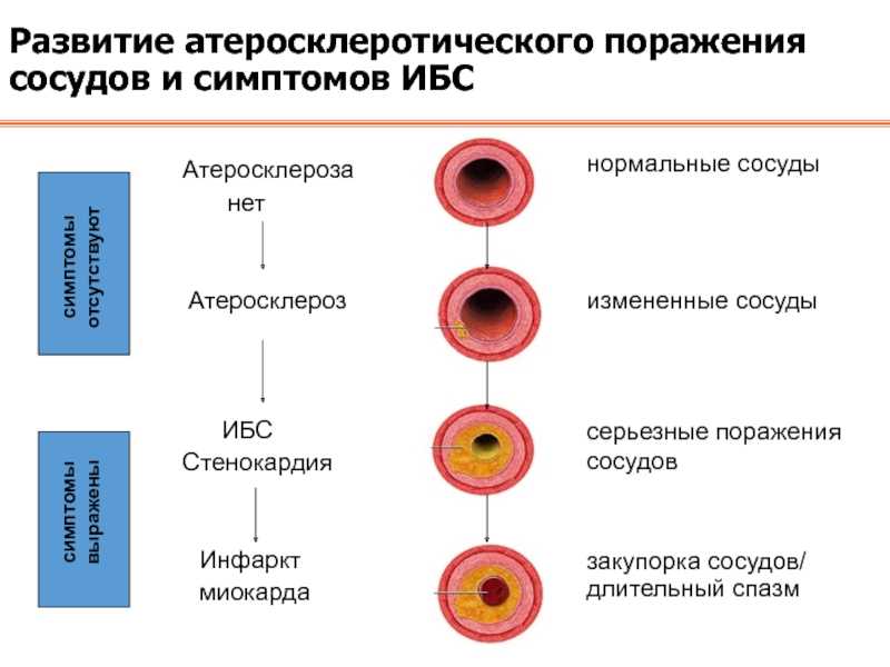 Облитерирующие поражения сосудов конечностей — большая медицинская энциклопедия