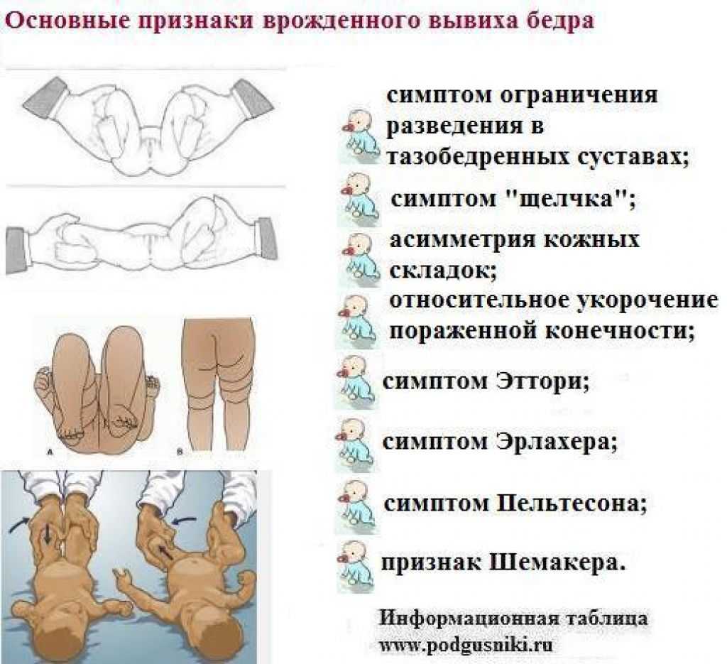 Дисплазии соединительной ткани - статьи