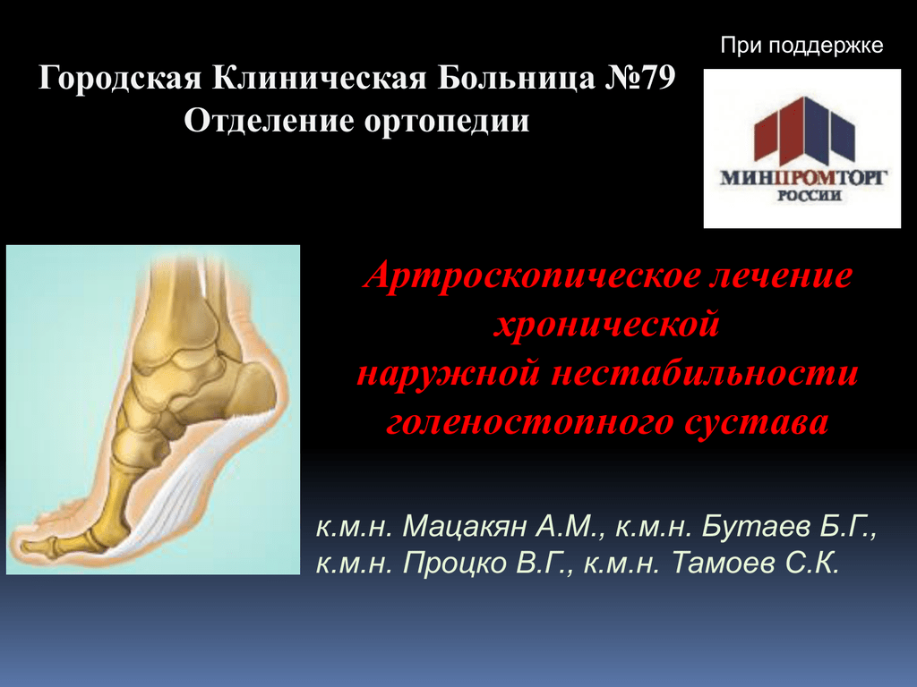 Лечение голеностопного сустава форум. Нестабильность голеностопного сустава. Хроническая нестабильность голеностопного сустава. Нестабильный голеностопный сустав. Нестабильность голеностопного сустава признаки.