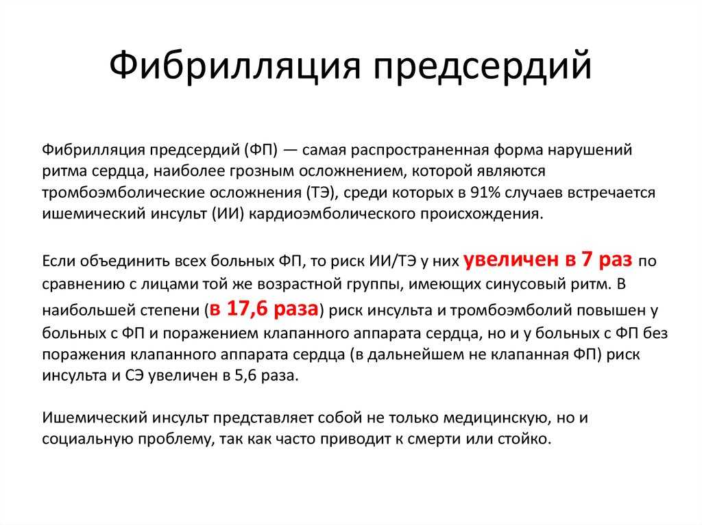 Аритмия