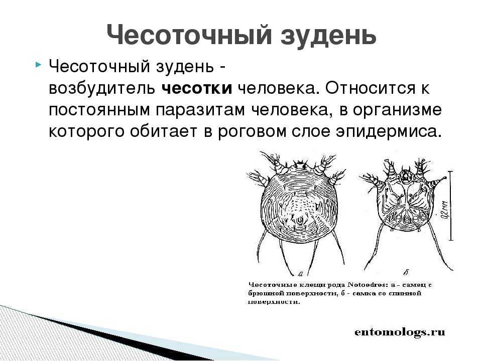 Чесотка: симптомы и лечение, как выглядит (фото)