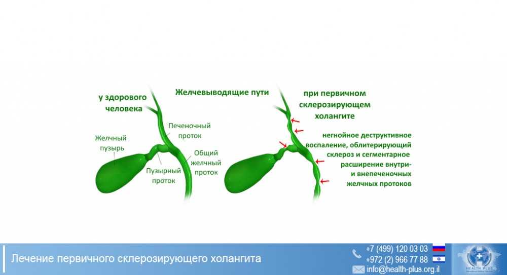 Узи желчного пузыря