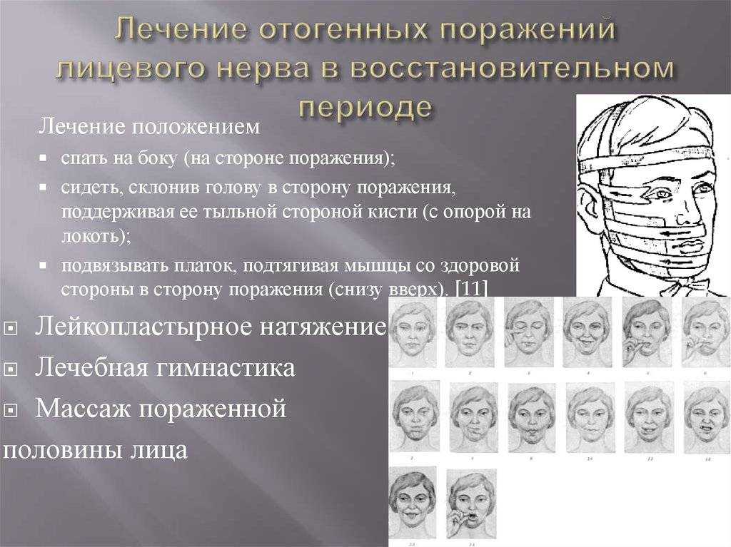Онемение конечностей