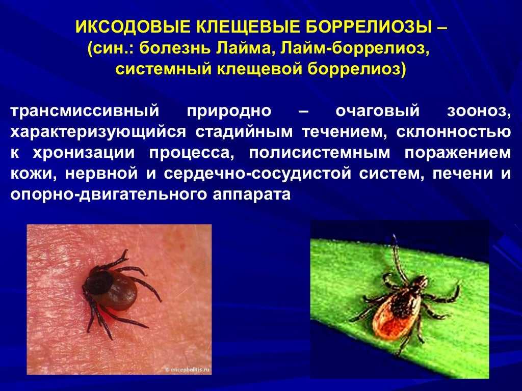Сердечно-сосудистые заболевания: классификация, симптомы, диагностика