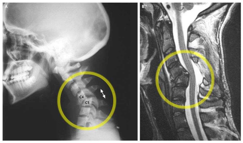 Шейный отдел позвоночника фото крупным планом