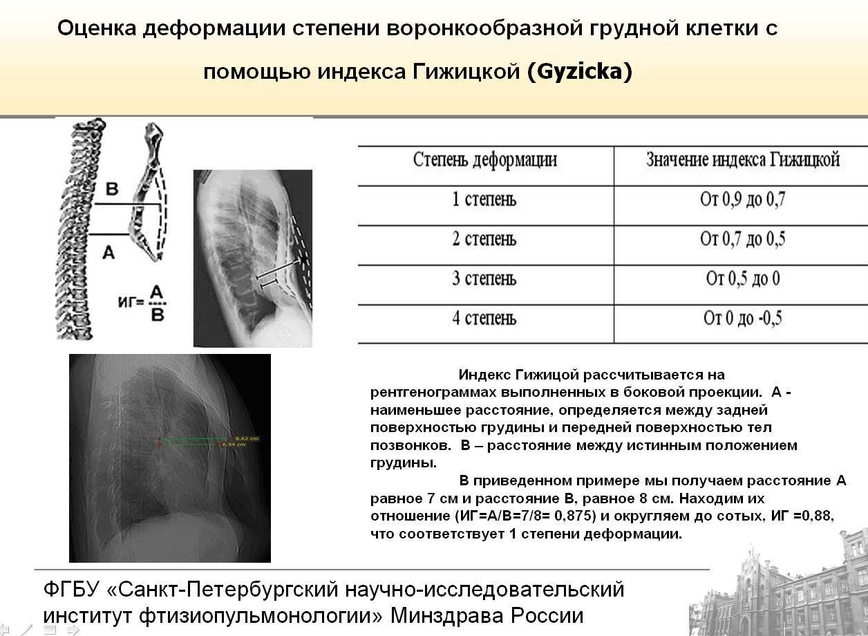 дефекты груди у мужчин фото 54