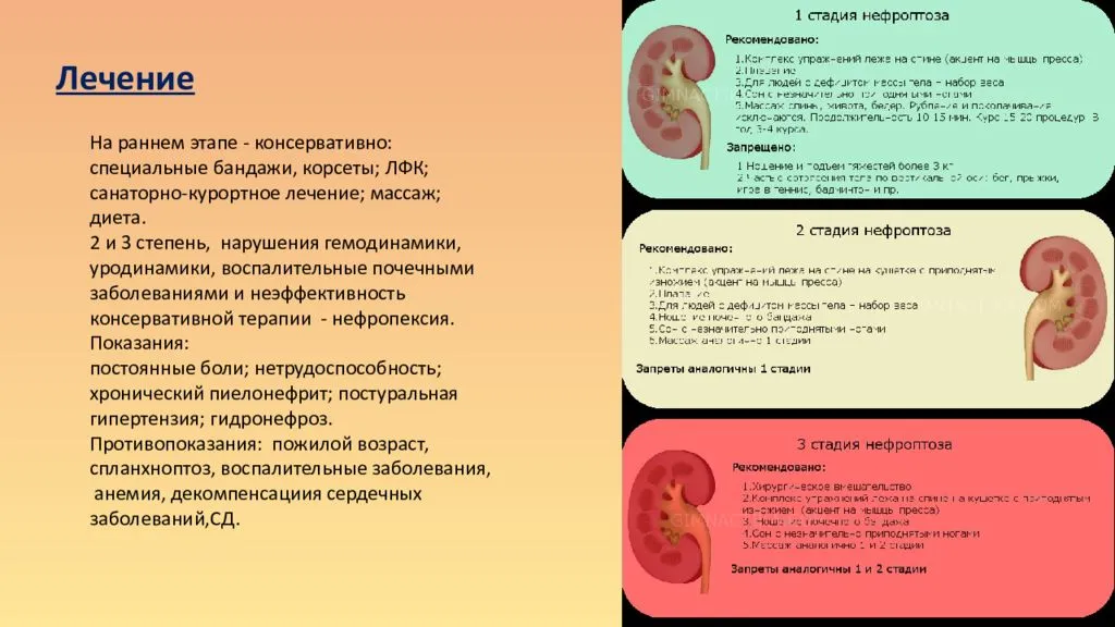 Уретерогидронефроз. причины, симптоматика, диагностика и лечение уретерогидронефроза