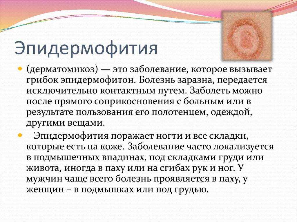 Повышенная потливость: симптомы, причины, лечение гипергидроза у женщин и мужчин | блог expert clinics
