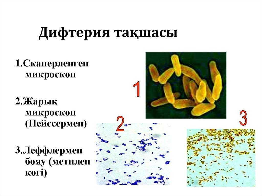 Профилактика дифтерии это