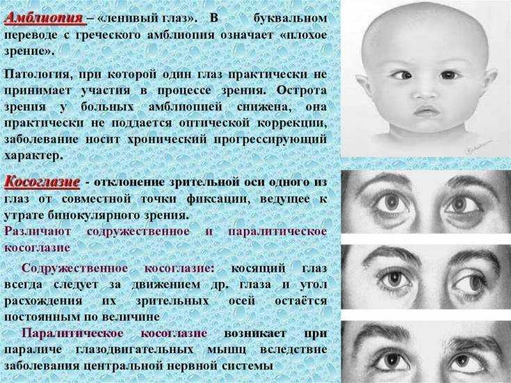Изменения полей зрения  - причины появления, методы диагностики и лечение