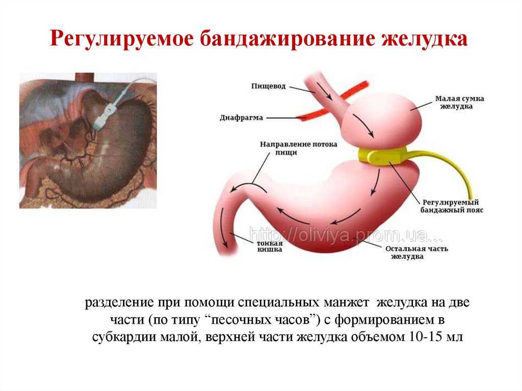 Диета после резекции желудка. рекомендации врачей