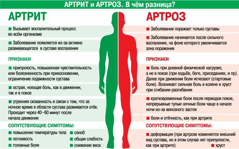 Ревматоидный артрит: симптомы, лечение по стандартам рф