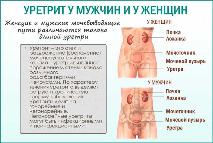 Уретрит клиническая картина