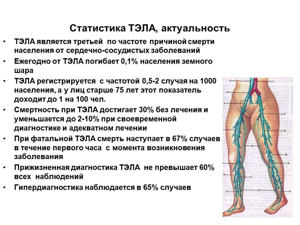 Тромбоз тэла. Клиническая картина тромбофлебита глубоких вен нижних. Тромбоэмболия легочной артерии (Тэла). Заболевания вен нижних конечностей Тэла. Основные симптомы Тэла.