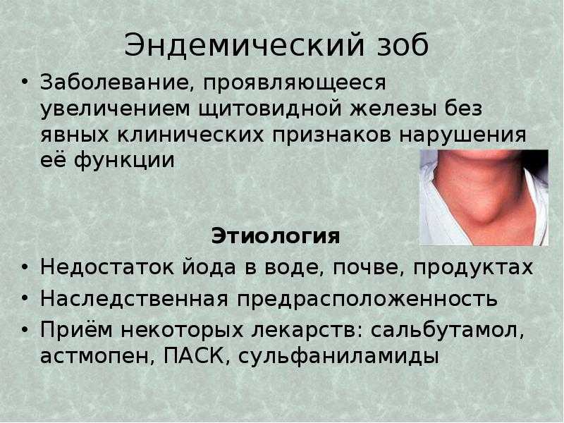 Клиническая картина эндемического зоба