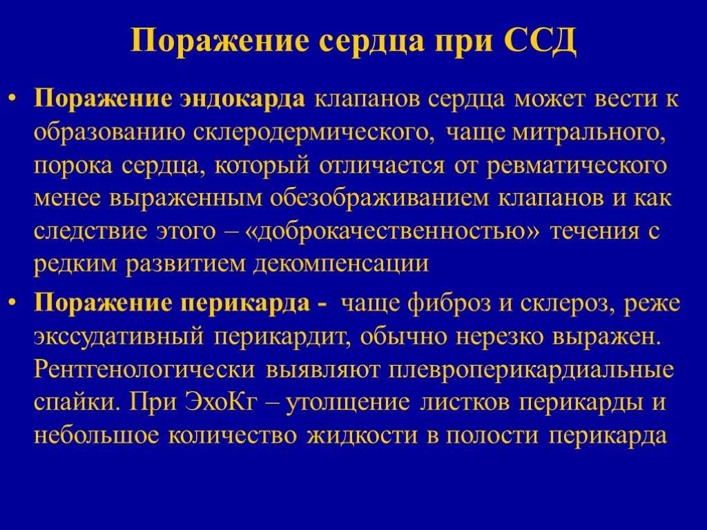 Склеродермия: лечение, диагностика, клинические рекомендации