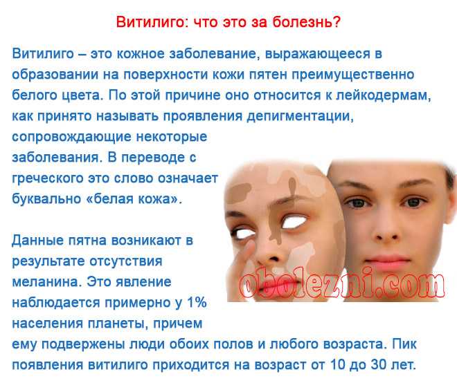 Кожные заболевания | статьи мц «диагностика