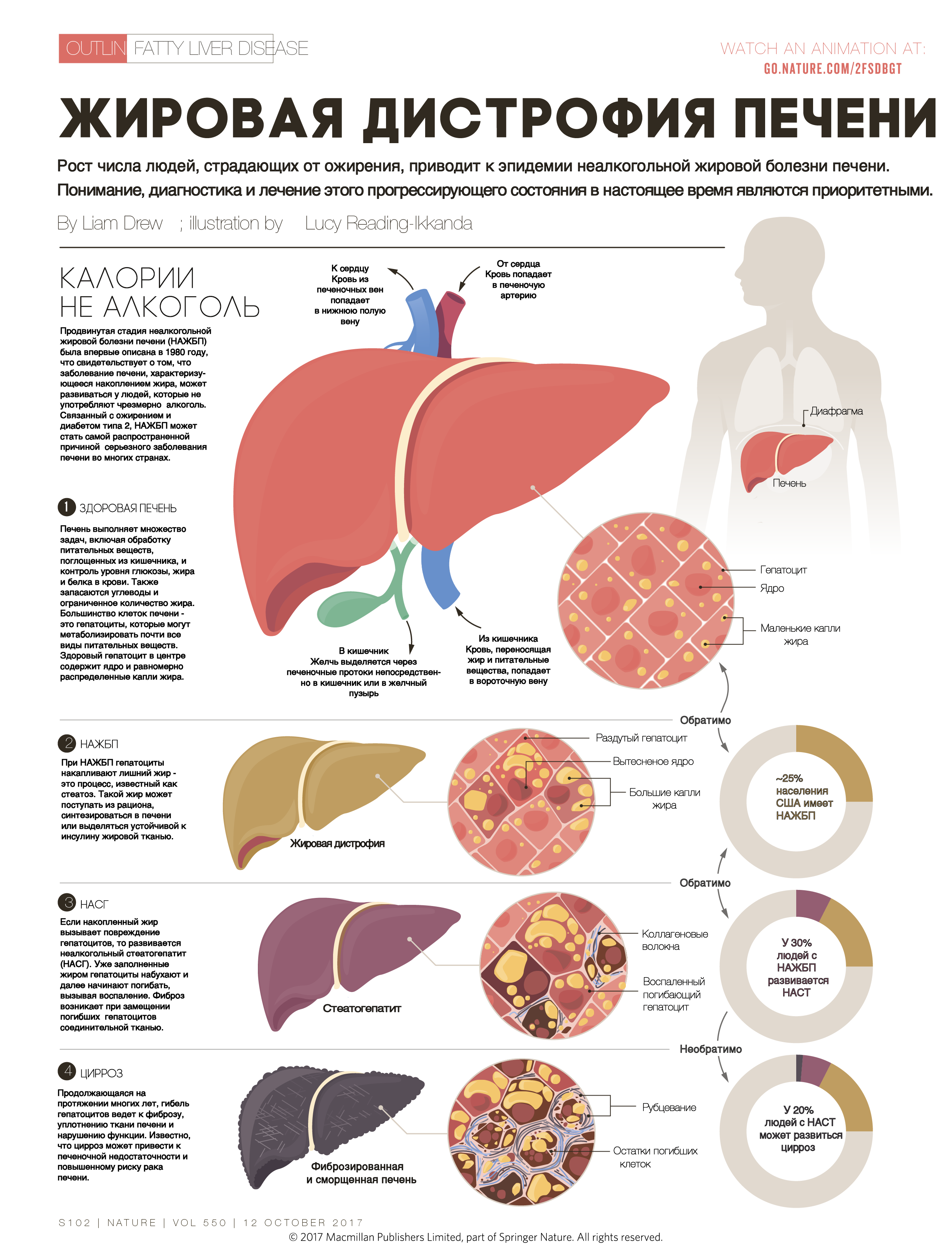 Жировая печень лечение. Неалкогольная жировая болезнь печени. Ожирение печени 2 степени. Неалкогольный жировой гепатоз печени. Жировая дистрофия печени этиология.