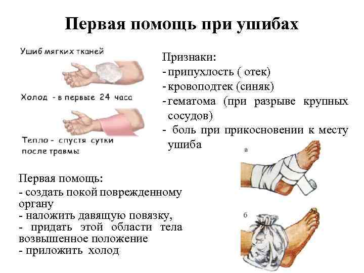 Что к ним относится к легким телесным повреждениям. ст. 115 ук рф