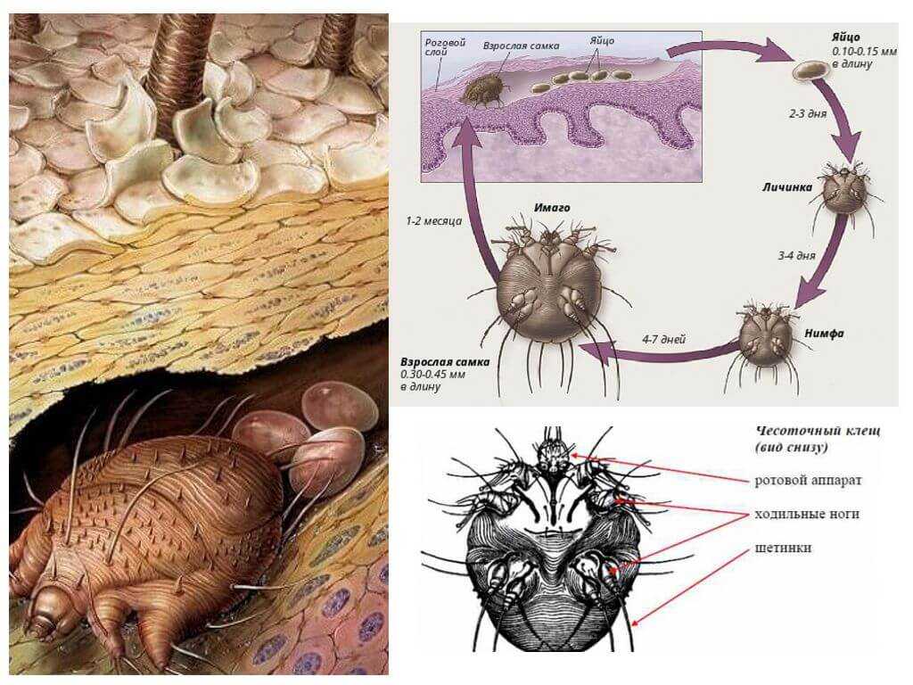 Какой цифрой обозначена на рисунке нимфа половозрелая личинка чесоточного клеща