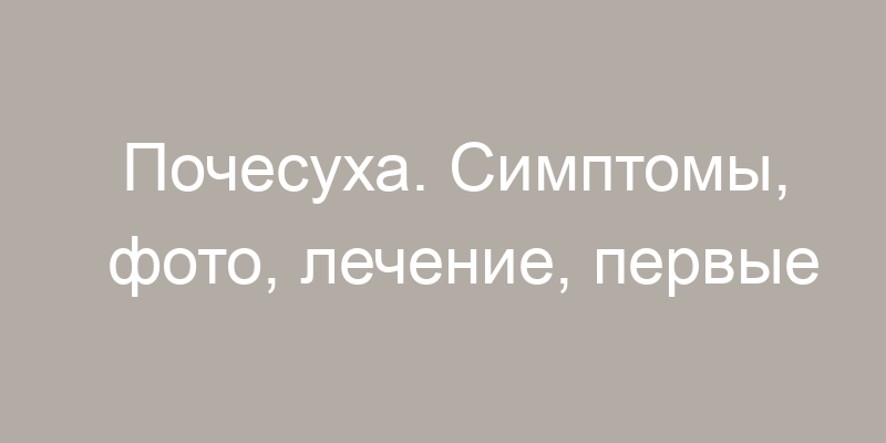 Нейродерматозы (нейродермит, кожный зуд, почесуха, крапивница): симптомы с фото, лечение