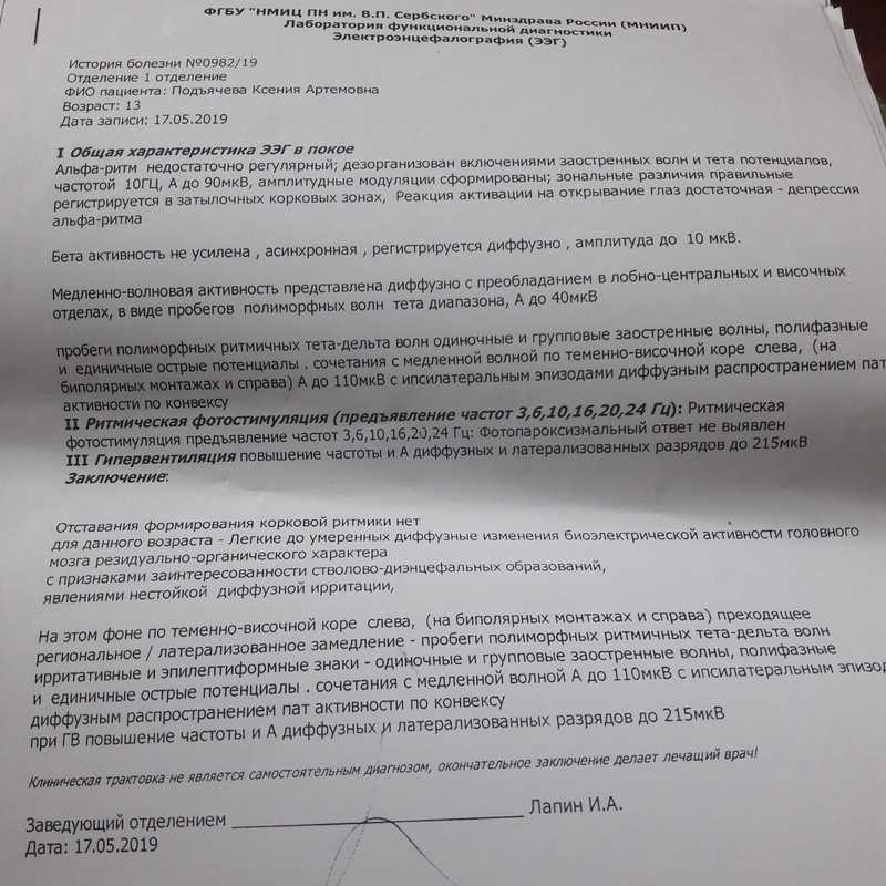 Сосудистые заболевания головного мозга