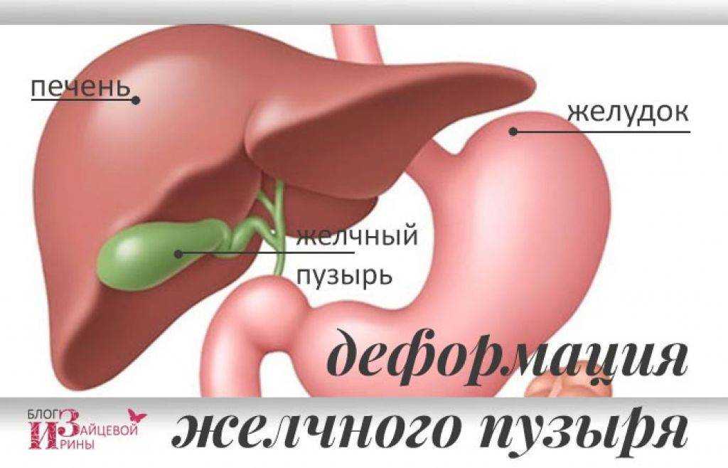 Лапароскопия желчного пузыря: показания и подготовка к операции | food and health